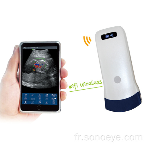 Scanner à ultrasons sans fil de type de la série convexe